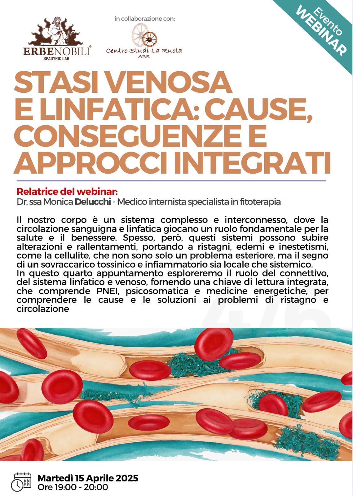 STASI VENOSA E LINFATICA: CAUSE, CONSEGUENZE E APPROCCI INTEGRATI